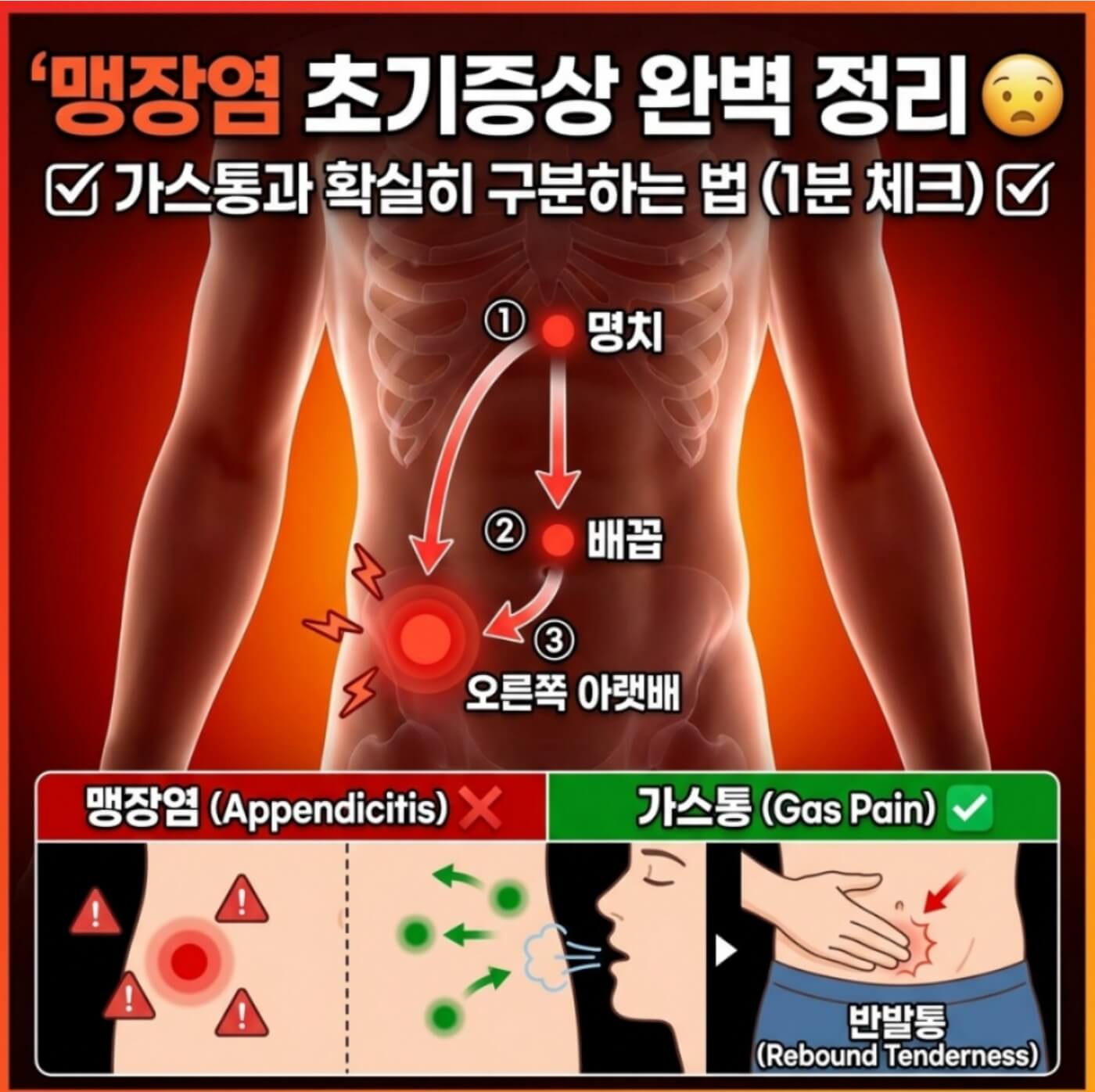 맹장염 초기증상