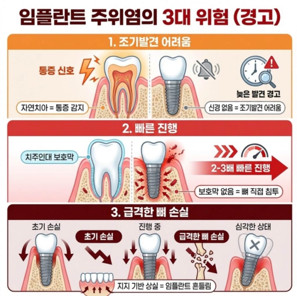 임플란트 주위염 예방 비타민 B3