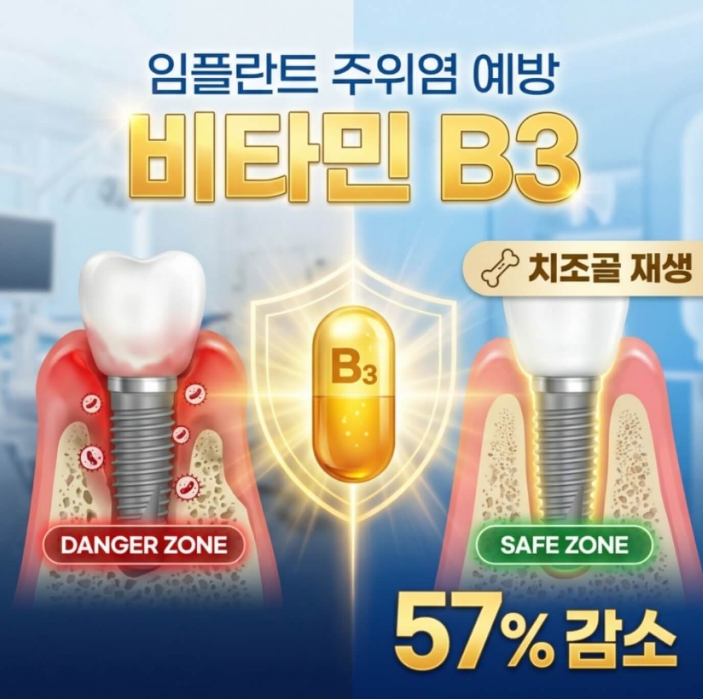 임플란트 주위염 예방 비타민 B3