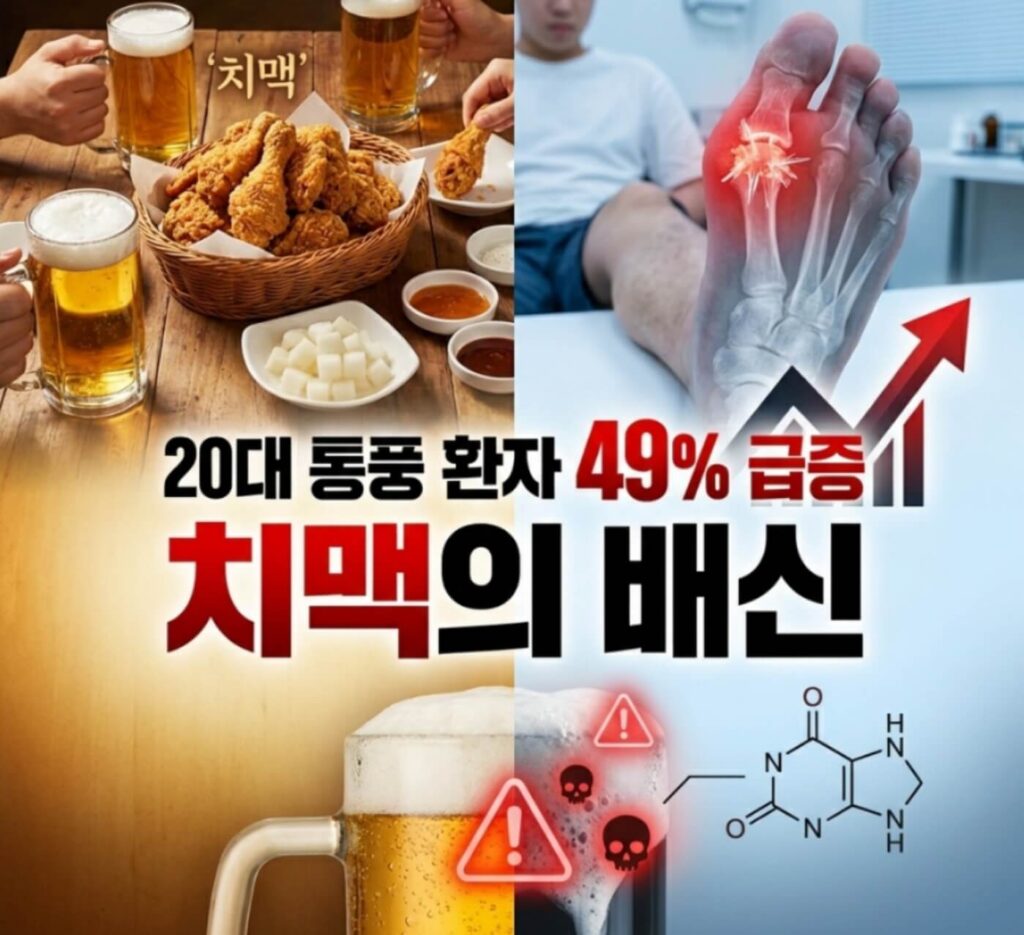 통풍 손목