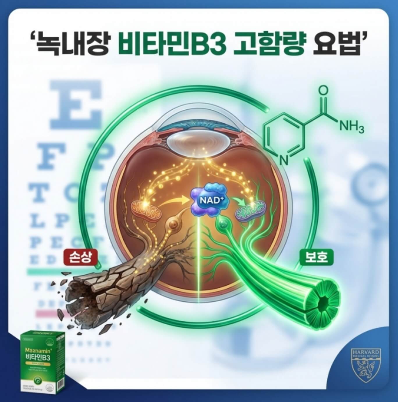 녹내장 비타민B3