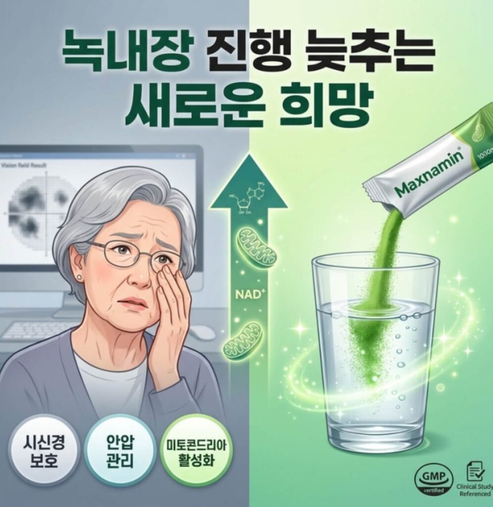 녹내장 비타민B3