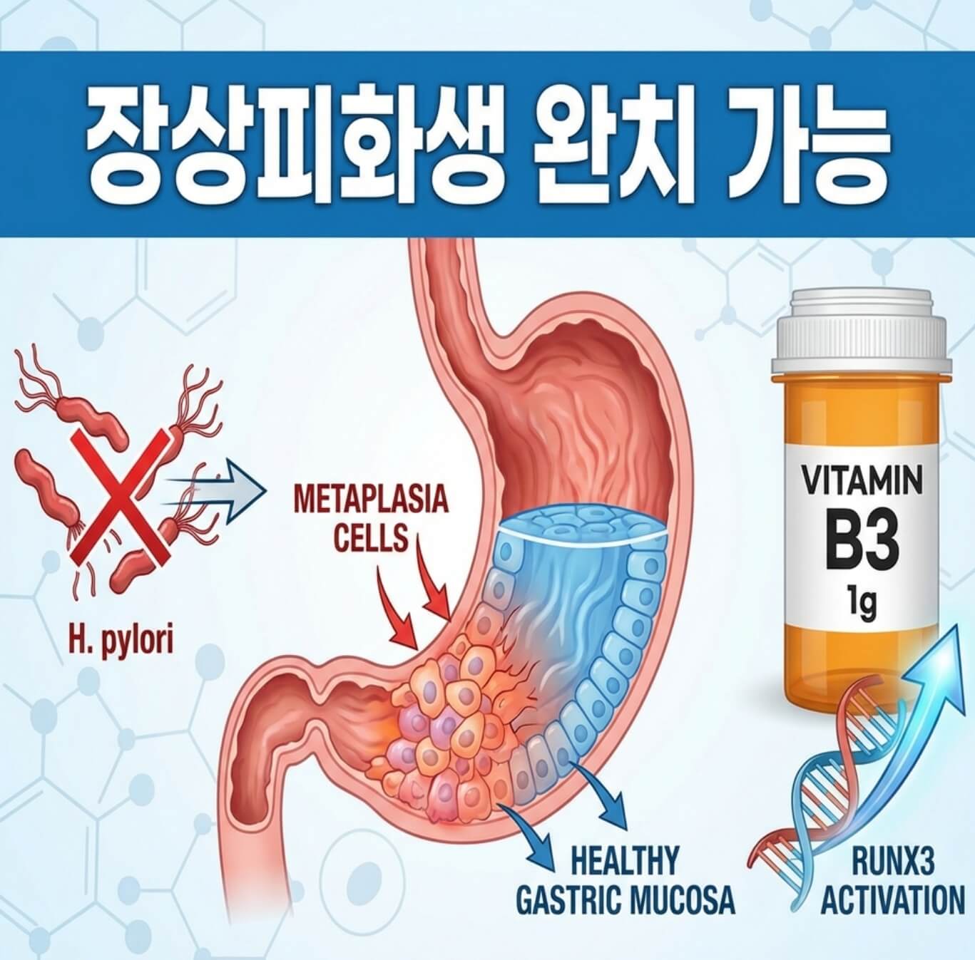 장상피화생 완치