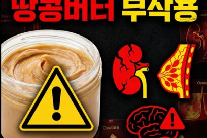 땅콩버터 부작용 — 매일 먹으면 옥살산·아플라톡신·오메가6 3중 위험