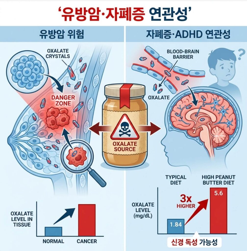 땅콩버터 부작용