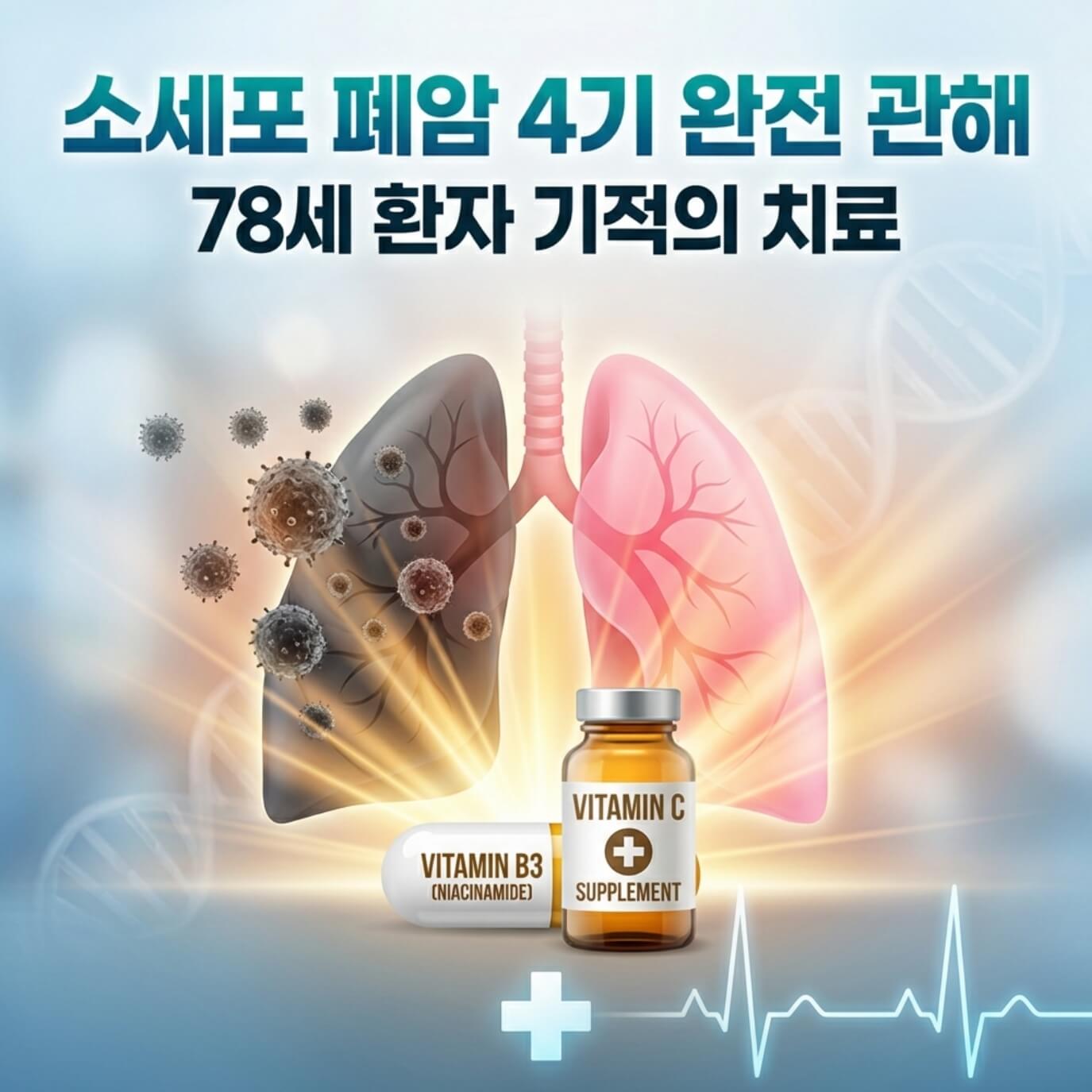 소세포 폐암 4기