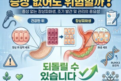 장상피화생 증상 없어도 위험할까? 내시경 진단 후 반드시 알아야 할 것
