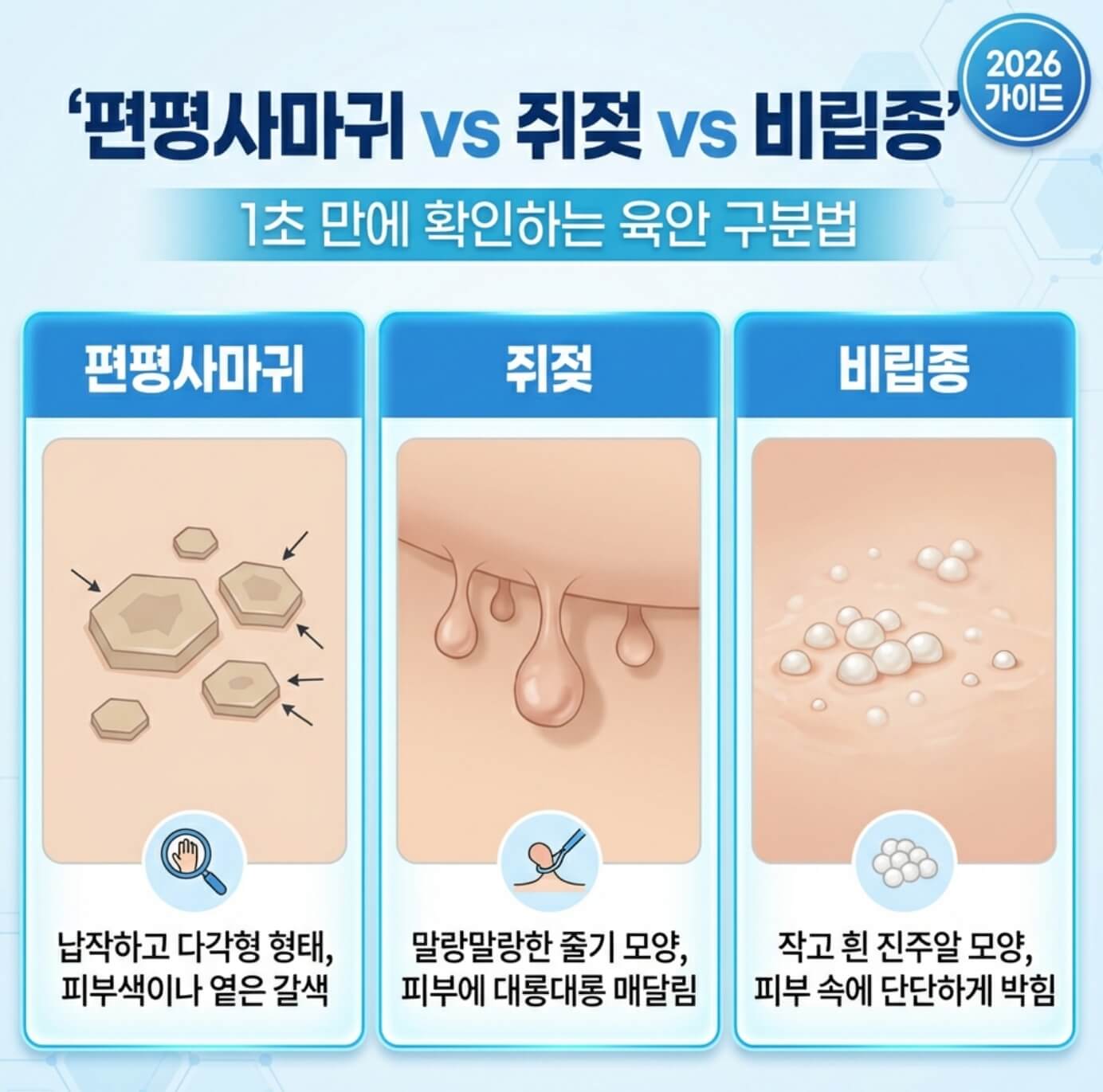 편평사마귀 vs 쥐젖 vs 비립종