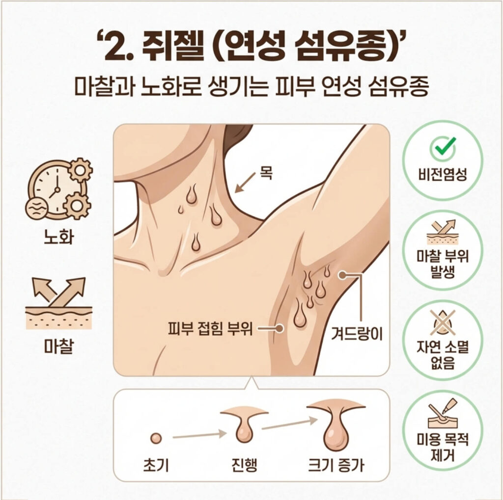 편평사마귀 vs 쥐젖 vs 비립종