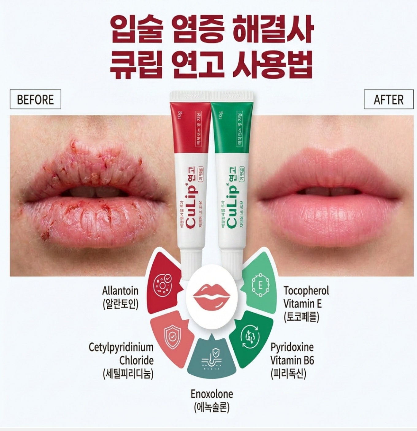 입술 염증 연고 큐립