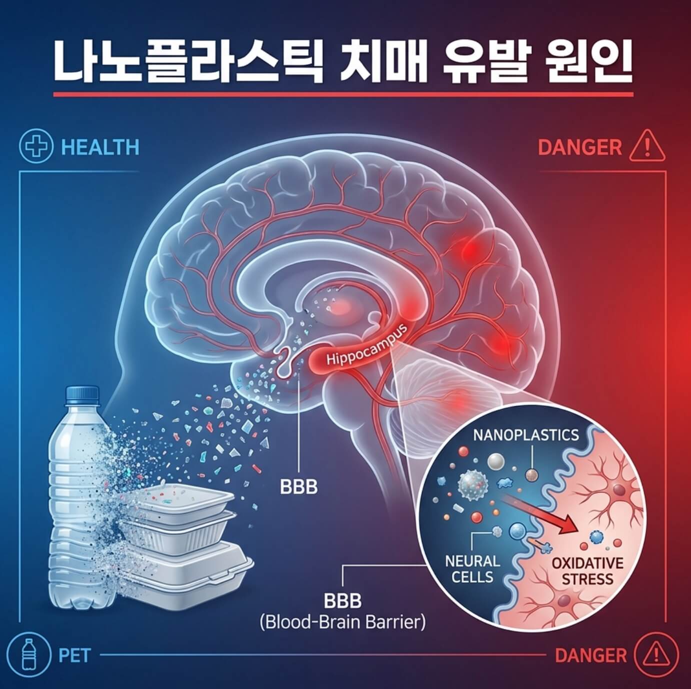 나노플라스틱 치매