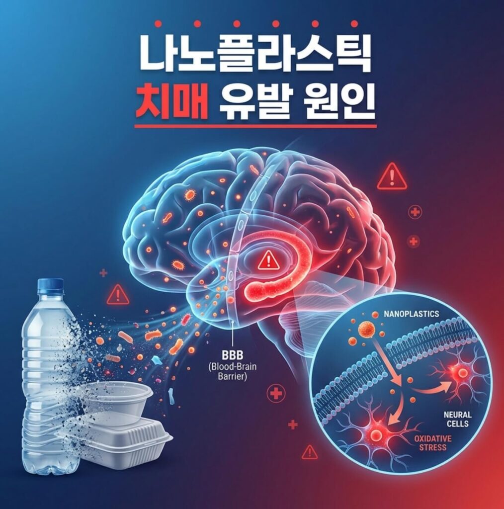 나노플라스틱 치매