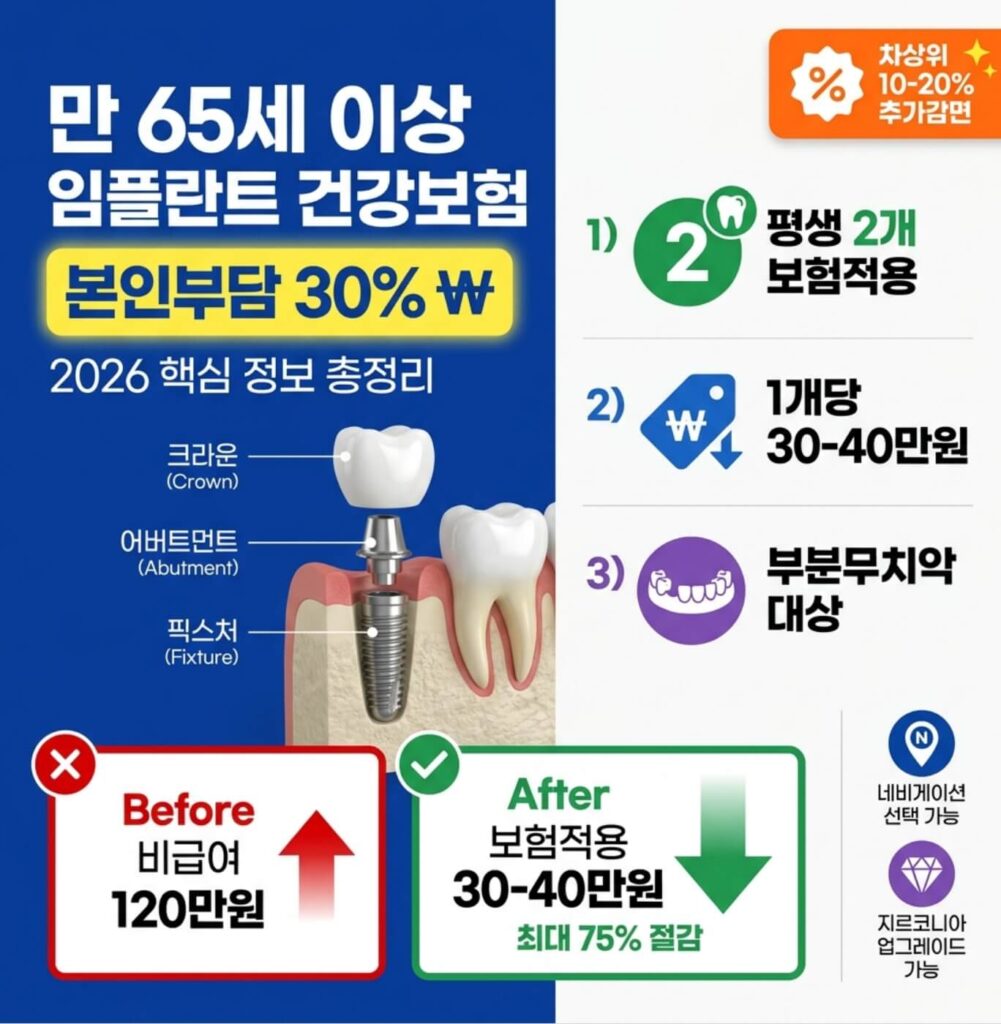 만 65세 이상 임플란트 본인부담금