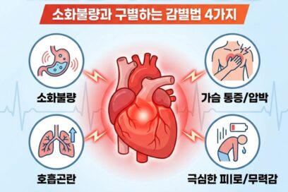 심근경색 전조 증상, 단순 소화불량과 구별하는 감별법 4가지