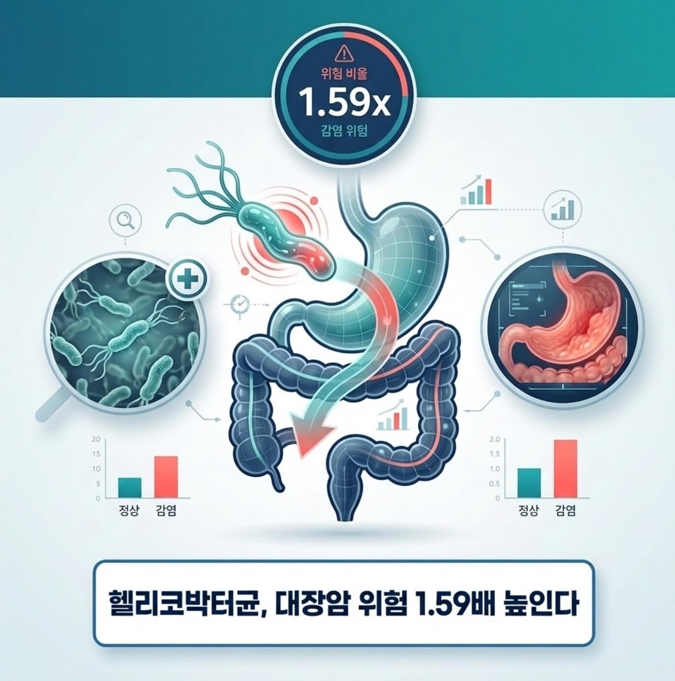 헬리코박터균 대장암