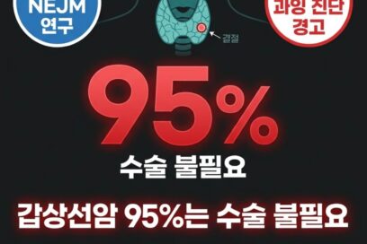 갑상선암 수술 95%가 불필요했다? 암환자 폭증 이면의 과잉 진단 진실