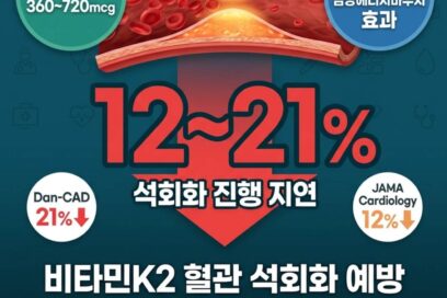 혈관 석회화 예방 영양제 비타민K2, 최신 임상 연구가 입증한 충격적인 진실