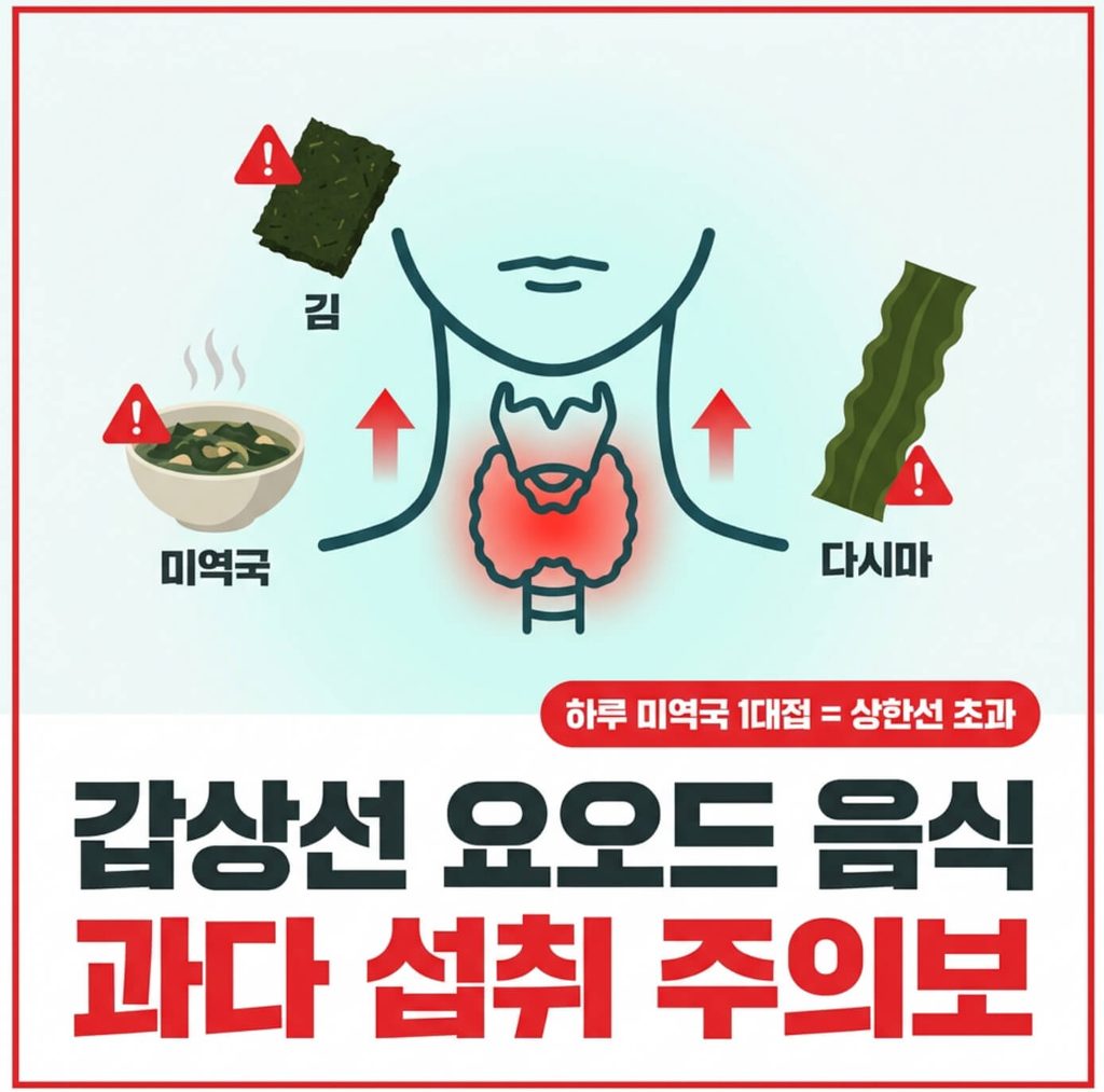 갑상선 요오드 음식